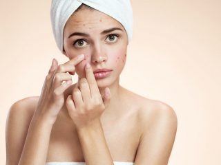 My reliable methods to fight acne